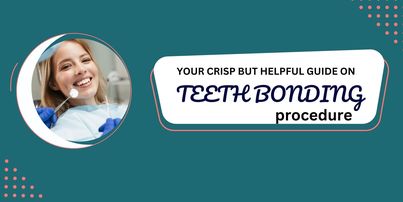 Your crisp but helpful guide on teeth bonding procedure
